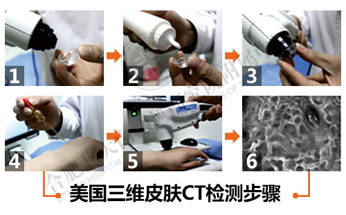 三维皮肤CT检测系统