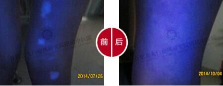 【第224面锦旗】突遇白斑喜康复，母亲锦旗致谢